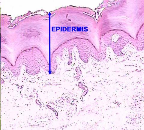 Skin Structure Epidermis outer layer Stratified squamous