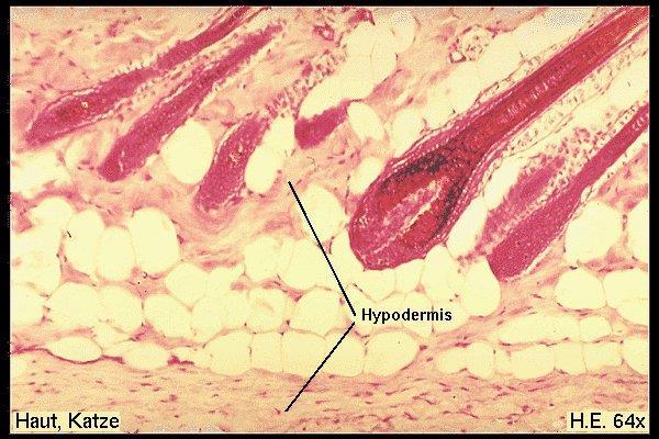 Skin Structure Deep to dermis is the hypodermis Not part of the skin