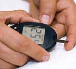 As there are not usually signs or symptoms for prediabetes, it is often discovered during a routine physical examination with basic screening for fasting blood sugar levels.