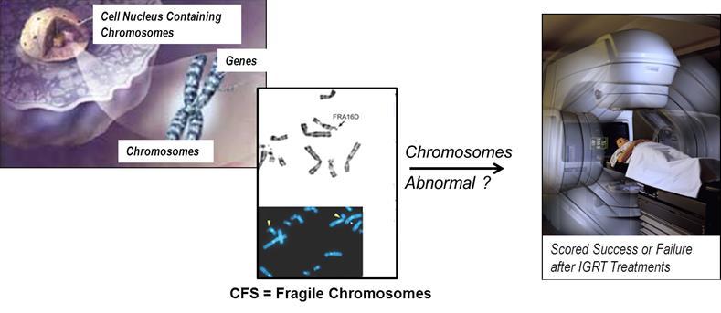 Unstable Chromosomes in Prostate Cancer A New Genetic Test for Sub-group Patients?