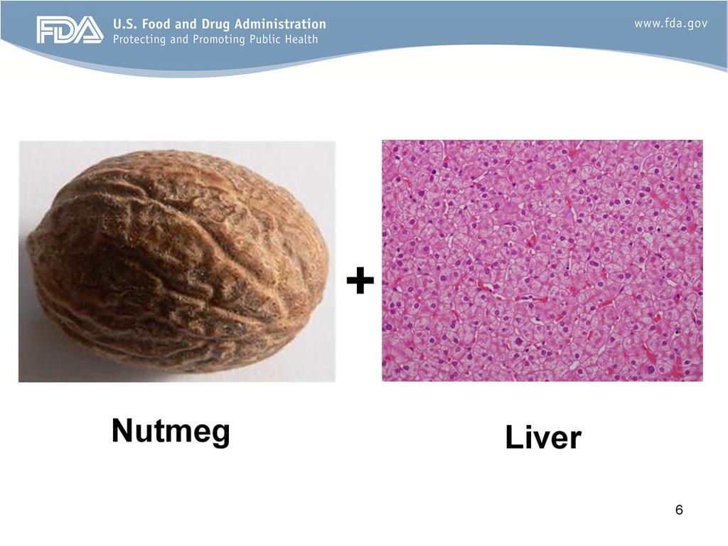 Well, what in the world is a nutmeg liver and how did we ever come up with that term? I am not a histopathologist. But, if you looked at the picture on the right, those are normal liver cells.