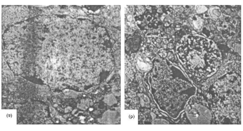 Fig. 2. Nuclear ultrastructure of normal cerebellar granule cells ( (a) 10 000) and cerebellar granule cells exposed to 500 µmol/l SNAP for 24 h ((b) 3 000). pattern (fig.