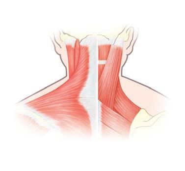 Sternocleidomastoid muscle Trapezius muscle Front view of neck muscles Strap muscles Neck muscles