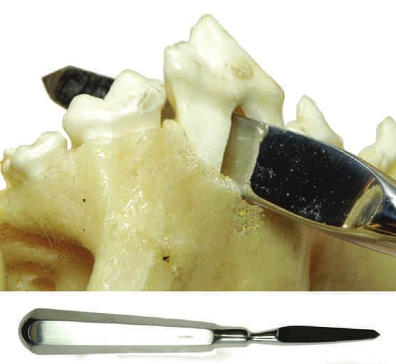 www.vetinst.com DENTAL HAND INSTRUMENTS 13 Wedge Elevator Designed to remove the Upper Premolar IV (the carnassial) without the need to split the tooth.