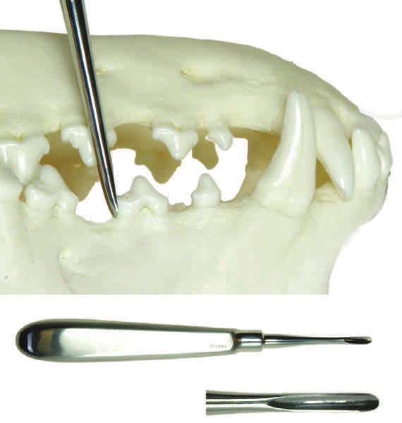 The blade of the instrument is then worked under the tooth. As the width of the blade increases the tooth is forced from the alveolus.
