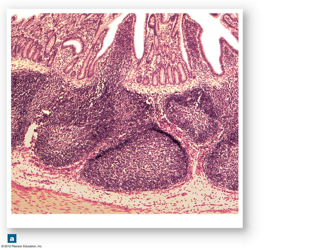 Figure 22-7a Lymphoid Nodules (Part 1 of 2) Intestinal lumen Aggregated lymphoid nodule Underlying