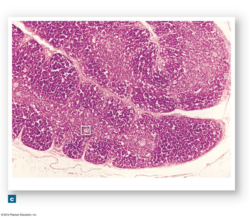 Figure 22-9c The Thymus Medulla Septa Cortex Lobule Lobule The thymus gland LM 50 Fibrous