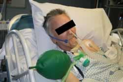A 4. Managing a tracheostomy emergency However skilled the individual caring for a patient with a tracheostomy emergency is, a number of tasks will need to be completed very quickly.