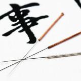 Agenda History Types of Acupuncture Physiological Effects Acupuncture - Improves