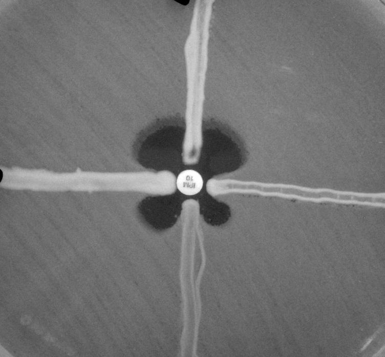 A D B C FIG. 1 The modified Hodge test using a 10 µg imipenem disk. Isolate A (K.
