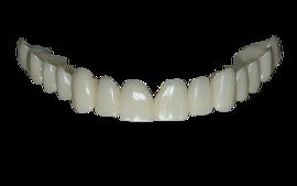 Milled PMMA Provisionals once the overall shape of the teeth and increased