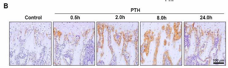 A B C Osteoblasts containing β-catenin (%) 1 8 6 4 2 ** ** * * Control.5h 2h 8h PTH 24h Figure 2. PTH single dose injection elevated β-catenin level in osteoblasts in mice.