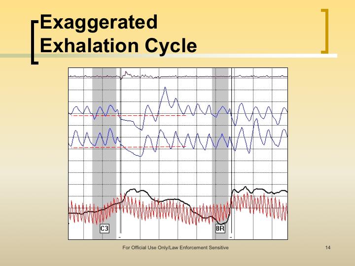 Left slide: Exaggerated exhalation cycle falling below the baseline. The upper pneumo moves up with a deep breath.