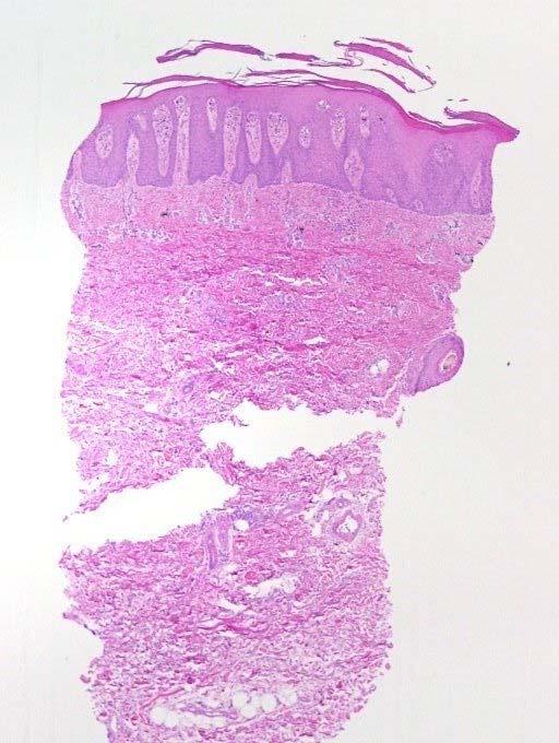 Figure 1: low power microscopic veiw shows regular