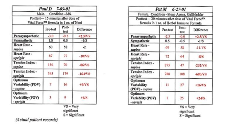 HRV Test Results Before and After Taking Stress Relief Jeffrey L. Marrongelle, D.C., C.C.N., Schuylkill Bio-Nutritional, Inc., Schuylkill Haven, Pa.