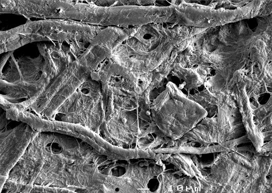 SEM analysis after gelation SEM was used to characterize the surface morphology of the PBP prepared at the optimum conditions discussed above.