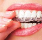 www.freshdentalcare.co.uk Am I too old for a brace? At Fresh Dental Care we don t think so!