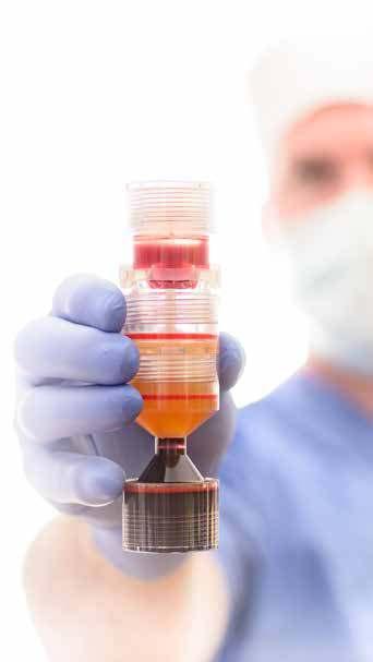 Considerations Prior to PRP Treatment Certain factors (e.g. Smoking and/or Alcohol) diminish stem cell release. Avoiding these will increase the success of the PRP procedure.
