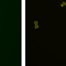 pairs of antibodies are minimal and the staining images
