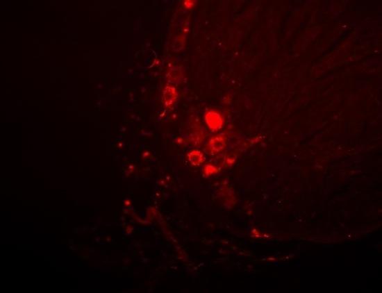 A subset of DRG neurons innervate both visceral organs: