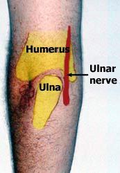 ulnar nerve is further increased (think of the way you hold your arm while imitating a chicken wing or as in a wrist to upper arm tie). Fig 1b. Blue areas are served by ulnar nerve Fig 1c.
