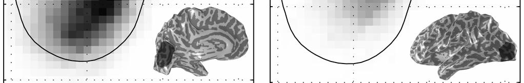 The inset figures show a smoothed version of the cortex at the boundary between white and gray matter. The shading describes the gyri (light) and sulci (dark).