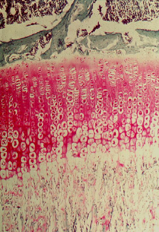 Histology of the Growth Plate Resting Zone Zone