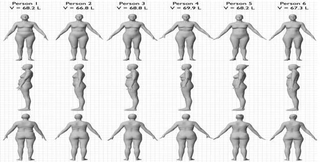 Obese Transplant Candidates http://akhdl.buzzfed.com/static/2 Can transplant 015- candidates loose weight?