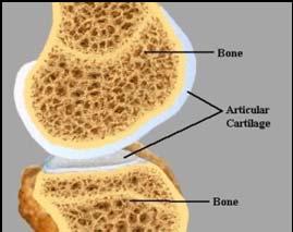 Knee Preservation and Articular Cartilage Restoration With