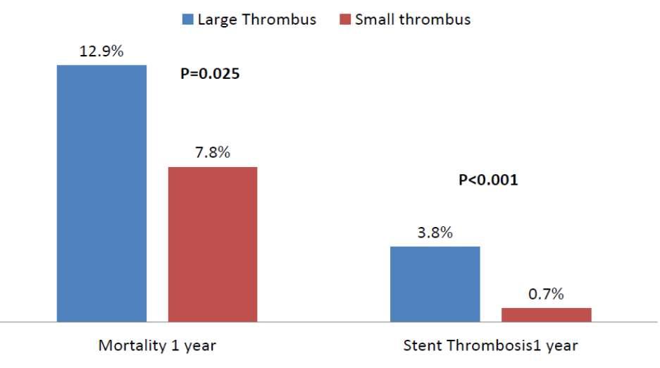 Thrombus in STEMI Worse outcome in patients with high