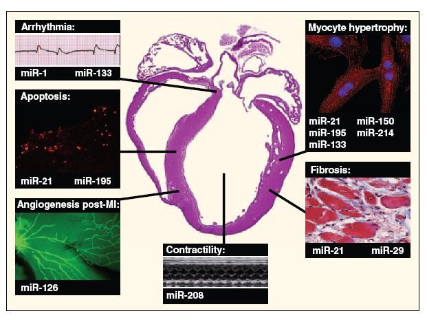 MicroRNAs in the heart mir-92a