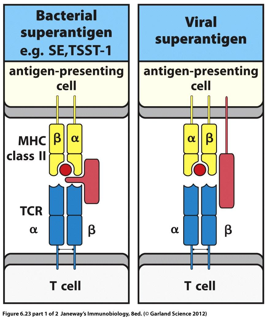 Bacterial toxic shock Many bacteria produce toxins that act as superantigens Bind simultaneously to Class II MHC and T cell