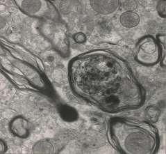 mitochondria characterized by neumerous ovoid lamellar bodies (EM