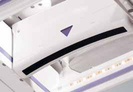 The 15 cm wide field-of-view transducer maintains uniform compression across the entire breast for consistent, reproducible image quality