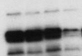 plus sijagb4 Western blot analysis for Notch1 Lanes 1,2 and 3 are 293T cells transiently
