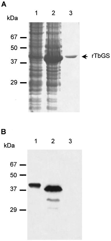 strains. Source: albicansmap.ahc.umn.edu Protein production (A) of rtbgs and immunoblot analsysis of the same protein (B). Source: Biochem. J.