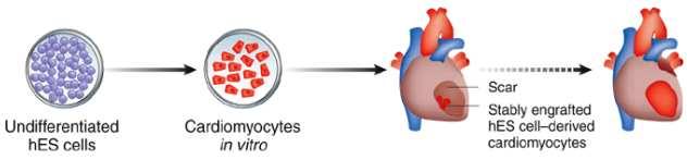 Embryonic stem cells for myocardial repair Since ESCs are able to differentiate into cardiomyocytes in vitro, they could be used as a source for cells that could eventually repopulate damaged