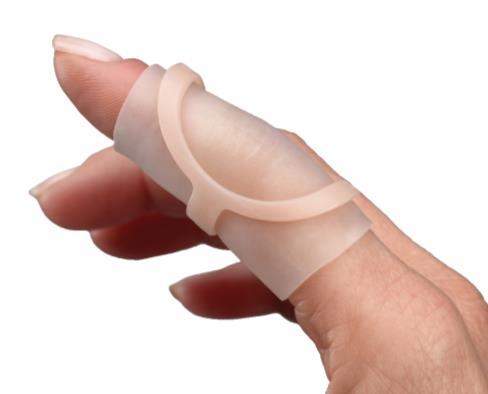 Chapter Four Purchasing Oval-8 Finger Splints Individual Splints Packages with only one size are a good option for those who have been sized by their