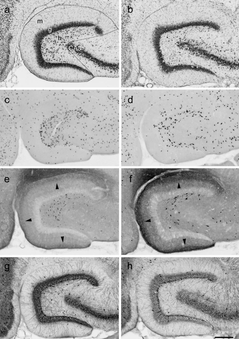 Kobayashi and Buckmaster Reduced Dentate Granule Cell Inhibition in Epilepsy J. Neurosci., March 15, 2003 23(6):2440 2452 2443 Figure 1.