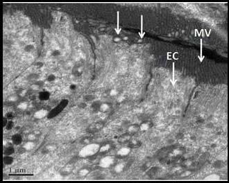 5 µm) Fig 5 and 6: Transmission electron micrographs of pyloric caeca of C. punctatus showing coccoid-shaped bacteria associated with the enterocyte microvilli (arrows).