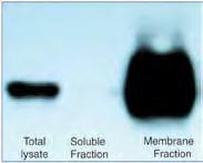 Protein Fractionation FOCUS Membrane Proteins FOCUS Membrane Proteins is a rapid and highly reproducible method for preparation of membrane or hydrophobic proteins from biological samples for 2D-gel