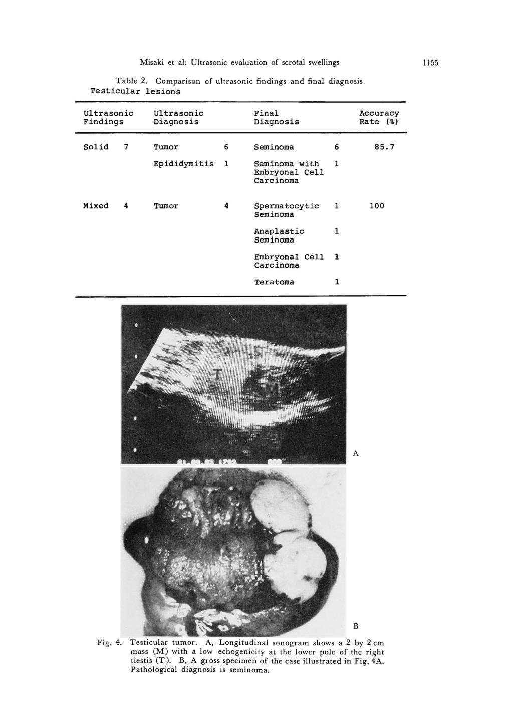 Misaki et al: Ultrasonic evaluation of scrotal swellings 1155 Table 2.