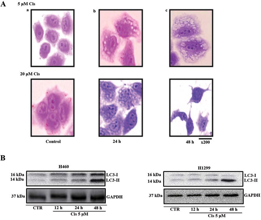 CHO et al: AUTOPHAGY BY LOW-DOSE CISPLATIN 251 Figure 3. Morphological phenomena and LC3-II protein expression of autophagy in cisplatin-treated lung cancer cells.