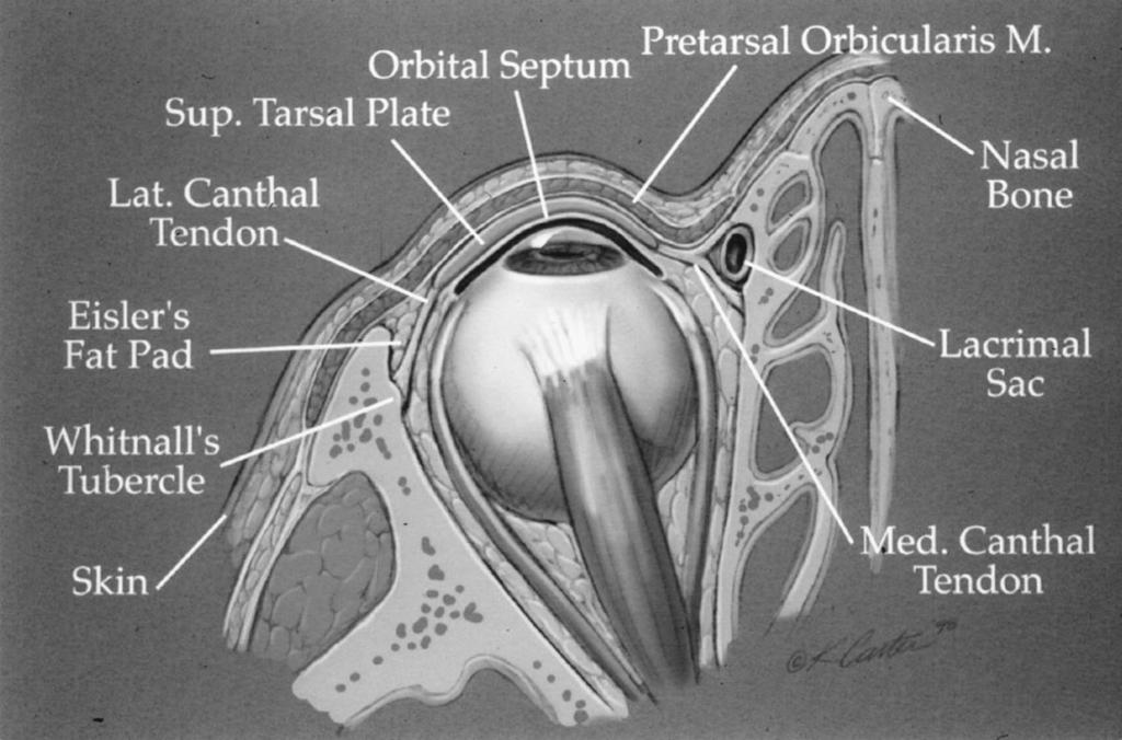 100e PLASTIC AND RECONSTRUCTIVE SURGERY, December 2004 and posterior fibrous attachments of the tarsal plate and fibers of the pretarsal orbicularis.