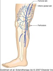 diameter Reticular veins (also known as feeder veins) o Have a cyanotic hue o 2 4 mm in diameter o Associated with
