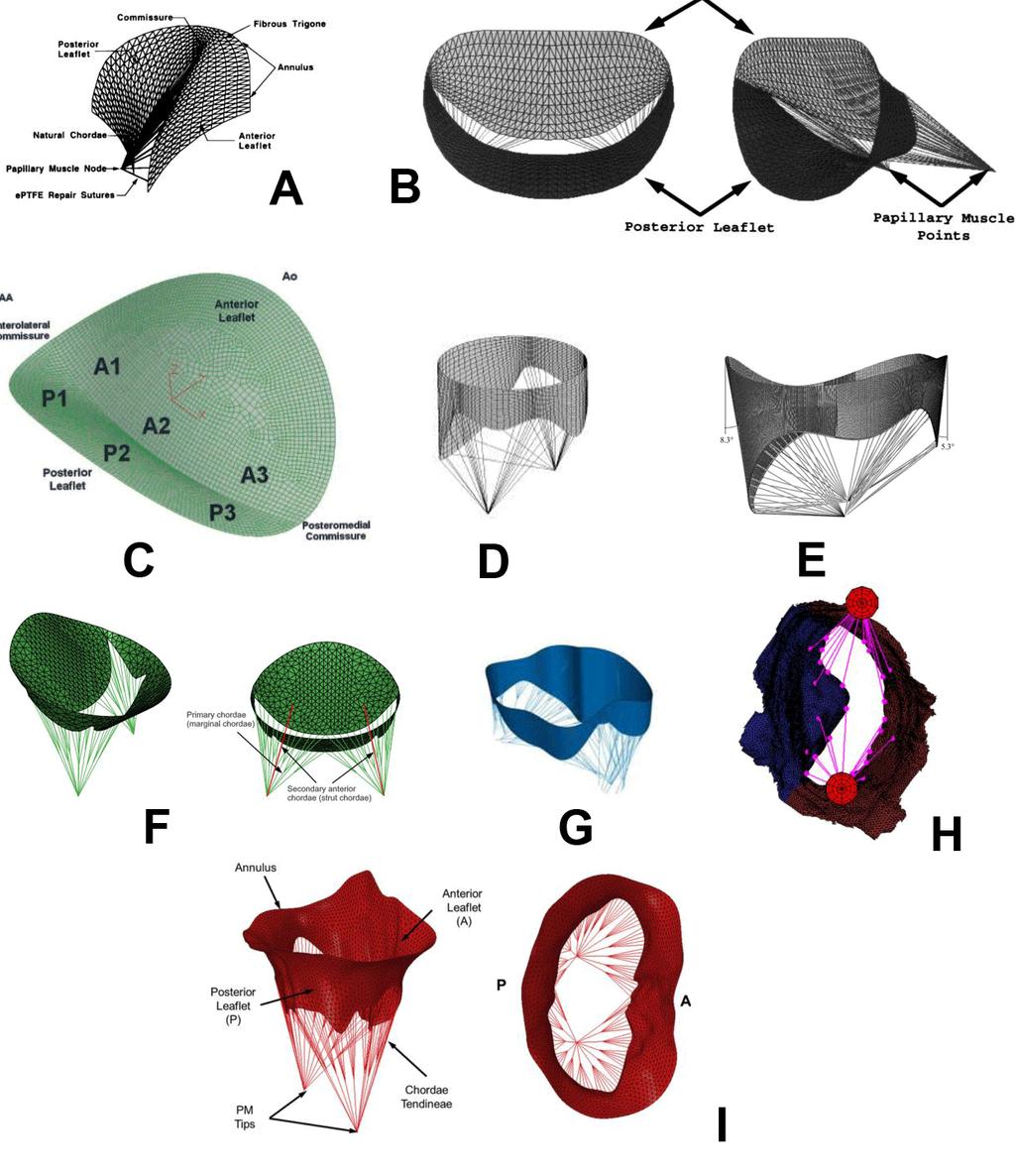 At the Figure 14 different FEA models of the mitral valve used in various research papers is depicted., Figure 14 Mitral valve FEA models in research papers by: A.