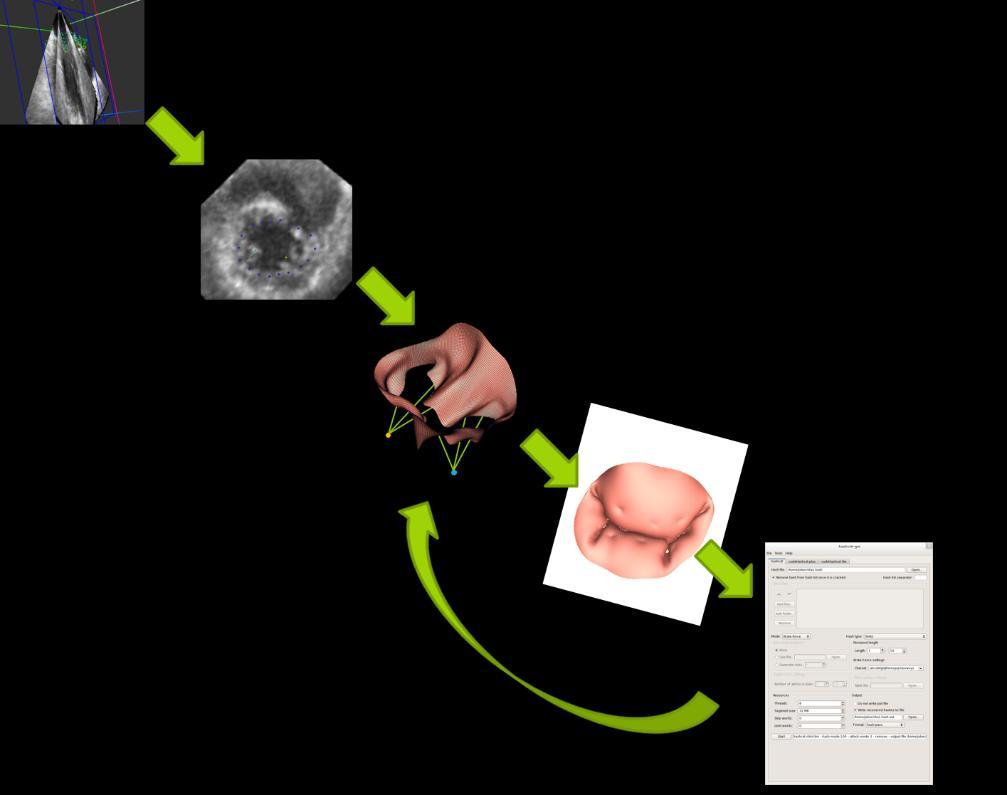 Figure 15 Framework for mitral valve FEA modeling Once the data is obtained, it s further post-processed in pyformex. With the help of pyformex, a patient-specific FEA model is generated.