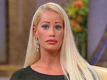 Human Barbie Jenny, late 20 s Three nose jobs, veneers on her teeth, three lip implants, two