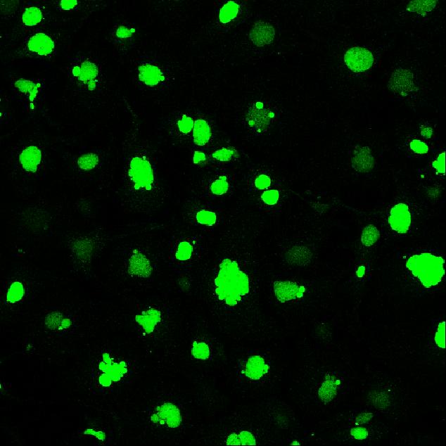 suppressor proteins distribution (in green) in cells treated with