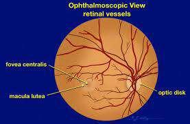 Review on Optic Disc Localization Techniques G.Jasmine PG Scholar Department of computer Science and Engineering V V College of Engineering Tisaiyanvilai, India jasminenesathebam@gmail.com Dr. S. Ebenezer Juliet M.